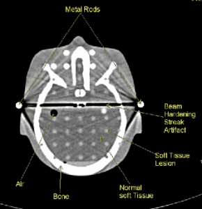 CT Artifacts | OncologyMedicalPhysics.com