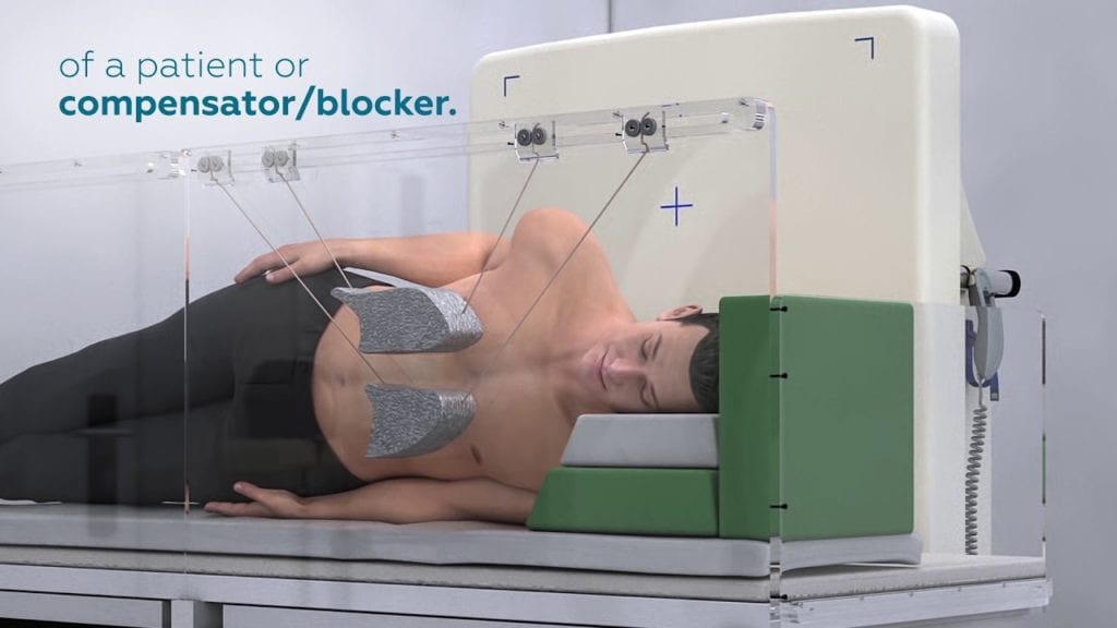 Tbi Radiotherapy Total Body Irradiation | OncologyMedicalPhysics.com