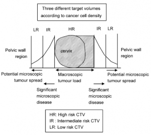 Gynecological Brachytherapy | Oncology Medical Physics