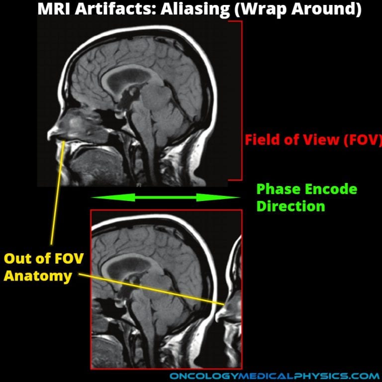 MRI Artifacts Oncology Medical Physics