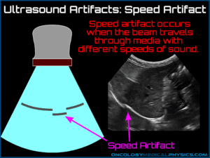 Ultrasound Artifacts | Oncology Medical Physics