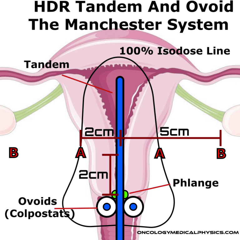 Gynecological brachytherapy oncology medical physics